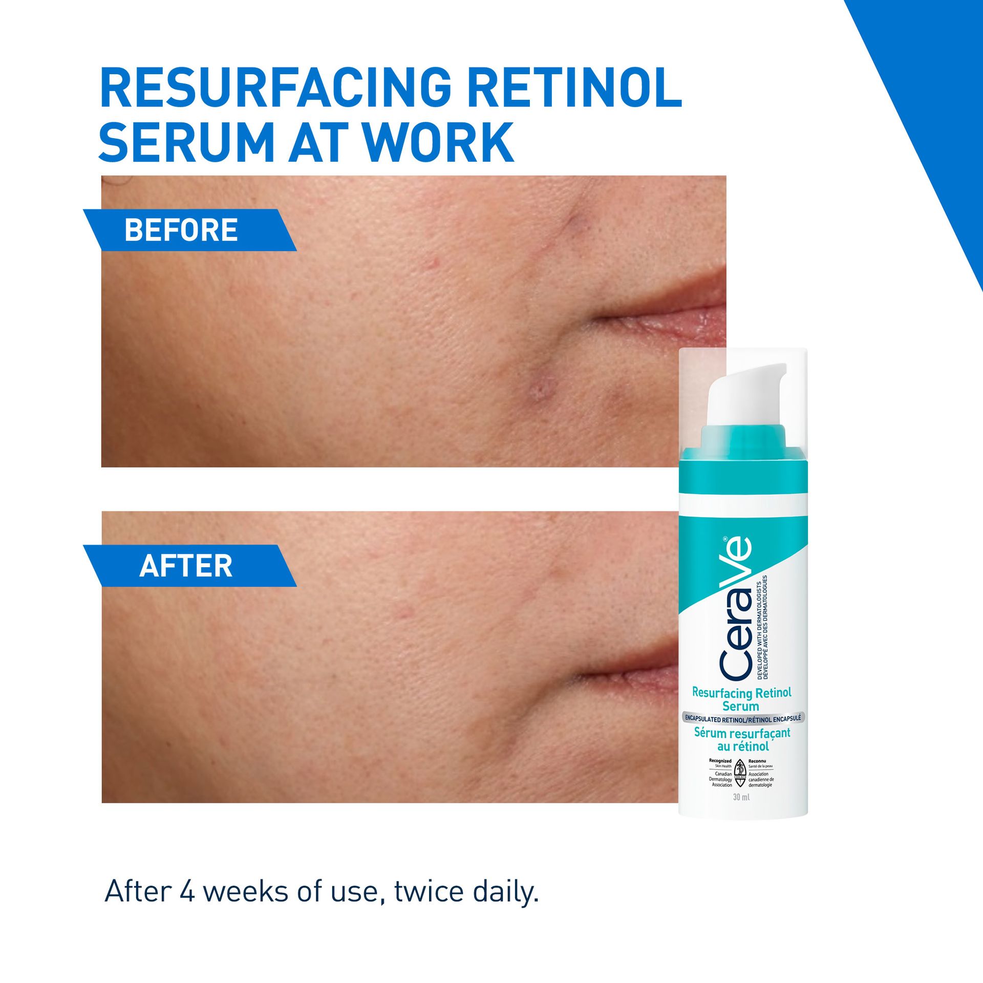 Resurfacing Retinol Serum | Smooth and Bright Skin | CeraVe